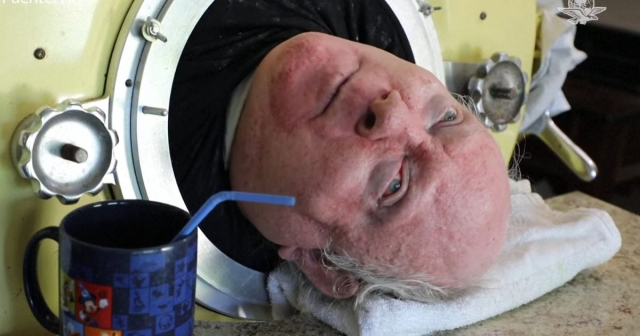 Murió a los 78 años Paul Alexander, el hombre del pulmón de acero