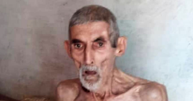 Ingresan a anciano cubano tras exponer su caso en redes sociales