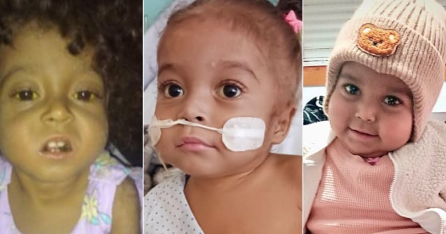 Impresionante evolución de la niña cubana Amanda tras ser operada en España 