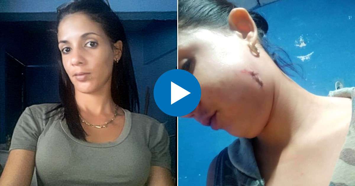 Facebook - Instagram / Keilylli de la Mora Valle