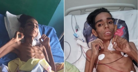 Miguel, el joven venezolano con desnutrición severa, que espera por la ayuda humanitaria