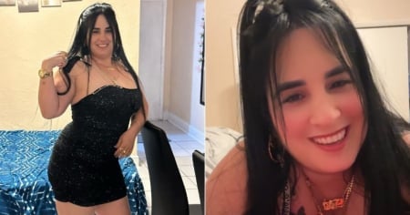 Madre cubana muere tras someterse a una cirugía estética en Miami