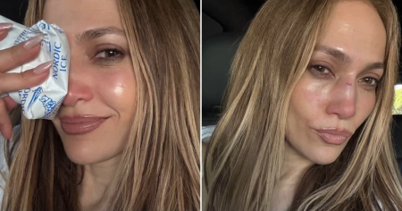 Jennifer Lopez sufre accidente en ensayo para los AMAs y muestra cómo quedó su nariz: ¡Tuvieron que ponerle puntos!