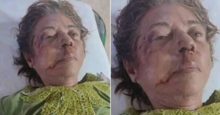 Atropellan y abandonan a periodista retirada en Ciego de Ávila: Nora Susana está grave