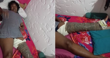 Cubana recién llegada a Uruguay denuncia abandono tras sufrir accidente: "Aquí no somos nadie"