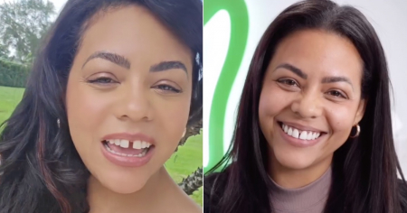 ¡Cambio radical! Laritza Bacallao muestra su nueva sonrisa y le llueven los piropos