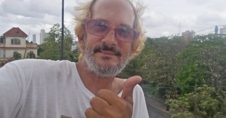 Se recupera músico víctima de violento asalto en La Habana, pero requiere ayuda para seguir trabajando