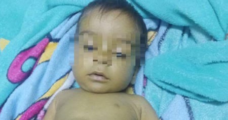 Clamor de una familia cubana: su bebé necesita un trasplante de hígado para sobrevivir
