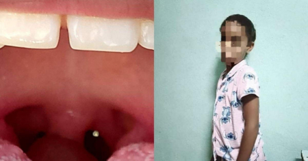 Piden ayuda para niña cubana de 10 años que padece enfermedad rara y peligrosa