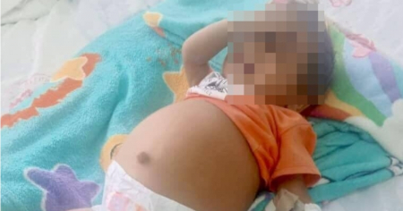 En estado crítico Rafa, el niño cubano que necesita un trasplante de hígado