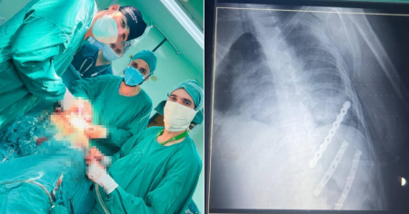 Accidente masivo en Holguín deja saldo de diez heridos: Uno fue operado de urgencia