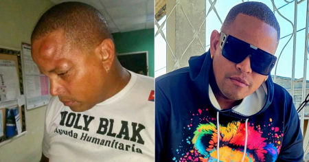 Activista Noly Blak sufre pérdida de memoria tras presunto accidente en Holguín