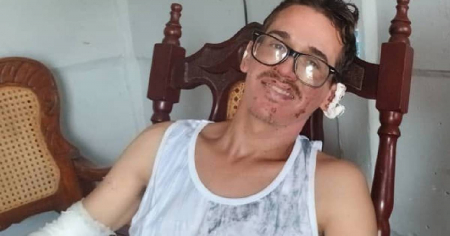 Se recupera otro de los cubanos heridos por la explosión en las parrandas de Guayos