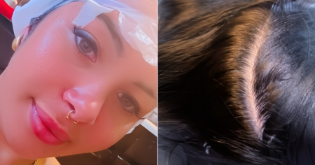 ¡No es lo peor que le pudo pasar! Fue a Cuba y cogió piojos: "No sé si reírme o llorar"