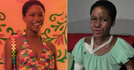 Modelo cubana habla tras sufrir graves quemaduras: "No pensaba salir del hospital"