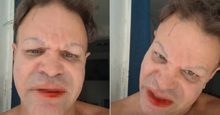 Transformista cubano denuncia agresión física por quejarse de los apagones en La Lisa