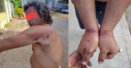 «Pensé que me iban a matar»: Cubano denuncia golpiza de seis policías en Guanabo