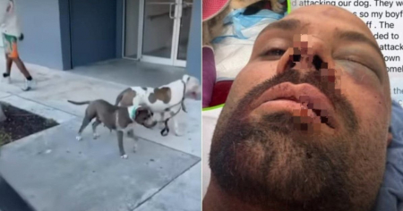 Brutal ataque de dos pitbulls a un corredor y su perro en Miami: El dueño fue detenido
