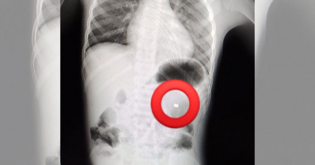 Hospital de Artemisa confirma que no había ambulancia para trasladar a niño herido de un disparo