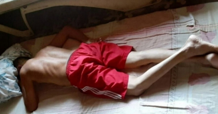 Activista Guillermo del Sol arriba a su día 46 en huelga de hambre con cuadro de grave deshidratación