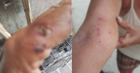«Mi mamá murió hablando del agua y de los apagones»: El desgarrador testimonio de una profesora cubana