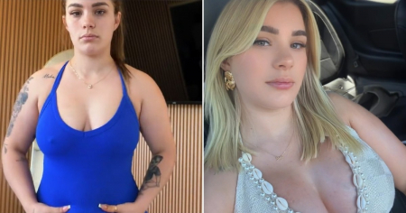 ¡Wow, su antes y después! Claudia Artiles responde a quienes decían que la cirugía le iba a «quedar mal por bajita»
