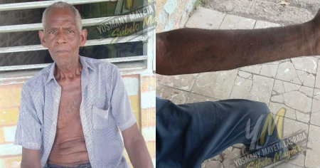 «Búscalo por fuera»: la respuesta que recibió el padre de Yosmany Mayeta ante la falta de medicamentos en Cuba