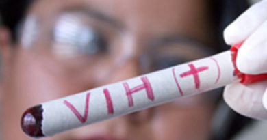 Más de 32 mil personas viven con VIH en Cuba