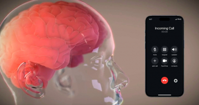 Elon Musk anuncia exitoso implante de chip cerebral en paciente humano