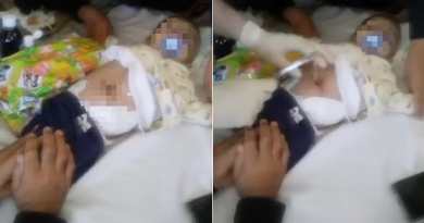 Bebé operado por hidrocefalia necesita medicamentos en Villa Clara
