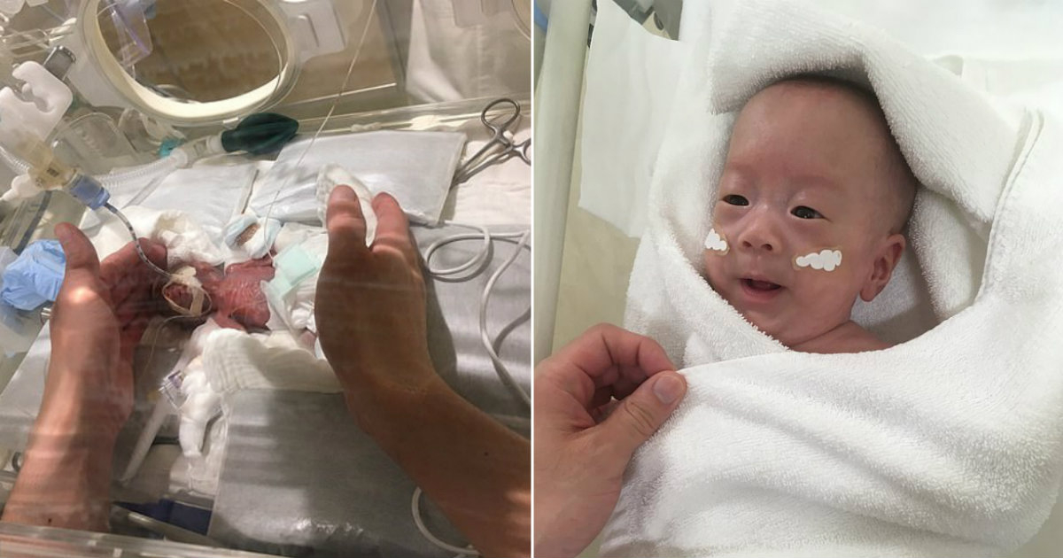 El bebé japonés que nació el pasado agosto con 268 gramos de pes © Reuters
