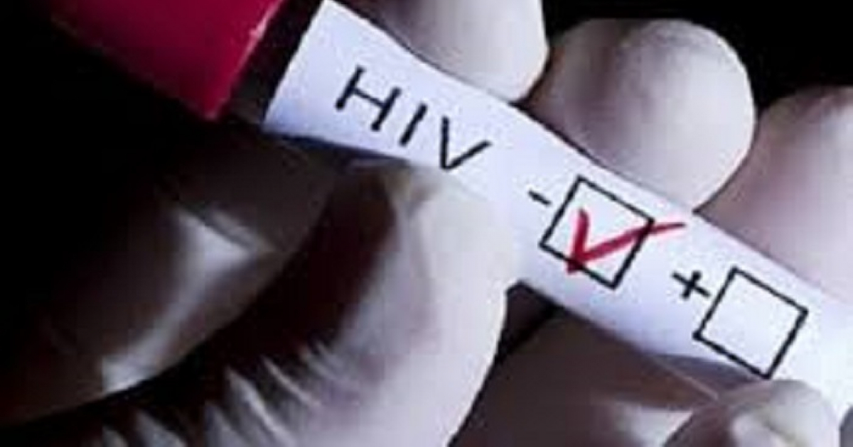 Pruebas de VIH © Pixabay