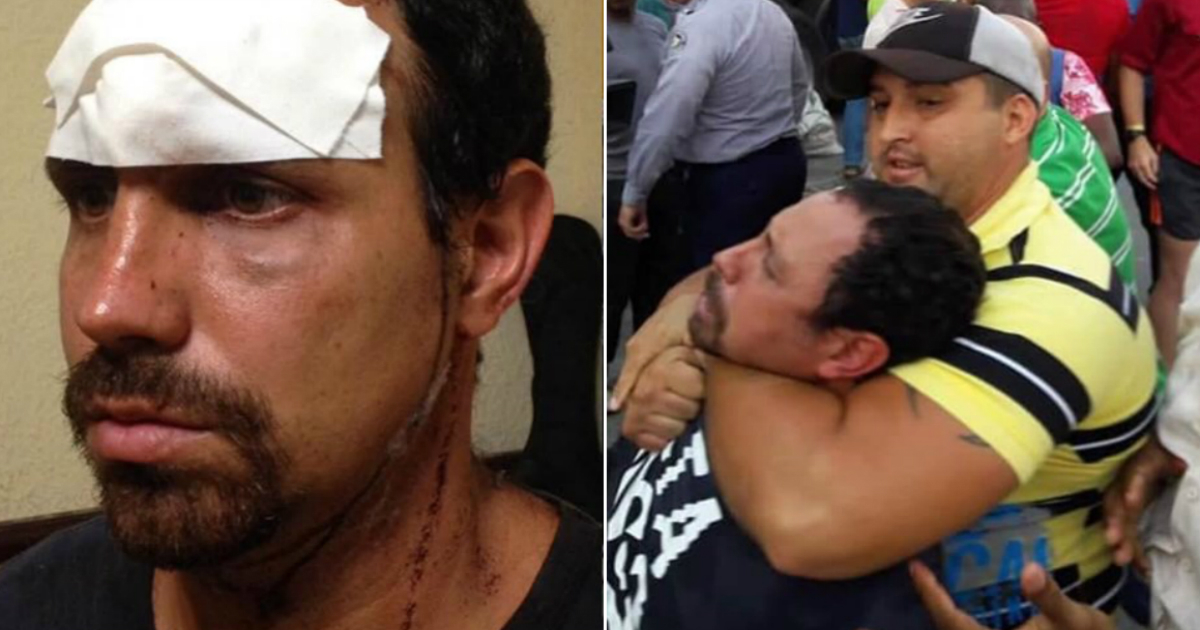 Heridas de Oscar Casanella y detención durante la marcha alternativa © Facebook / Rossana Reyes Rosa