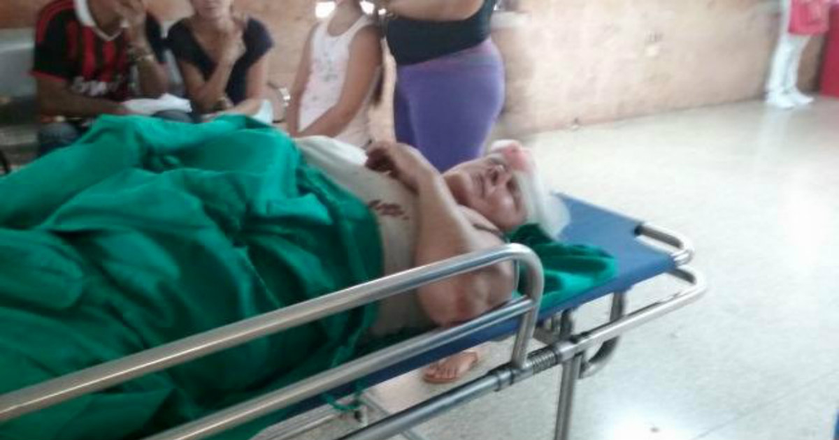 Maribel Soca Lamadrid, de 56 años, entre los lesionados. © Leonel Iparraguirre González / Facebook