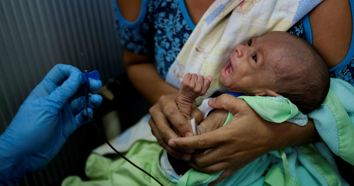 Niño desnutrido en Venezuela © REUTERS/Carlos García