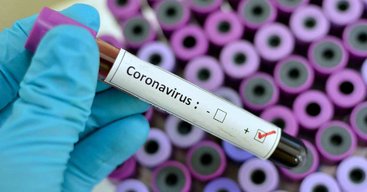Test positivo de coronavirus © who.int