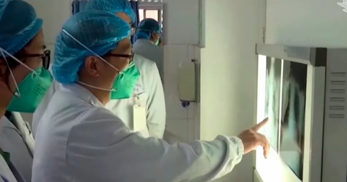 Médicos chinos miran una radiografía (Imagen referencial) © Captura de video de youtube
