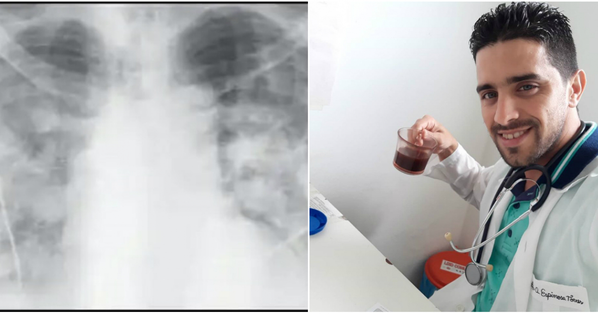 Médico cubano Luis Alberto Espinosa y radiografía de un paciente con coronavirus © Facebook / Luis Alberto Espinosa Torres
