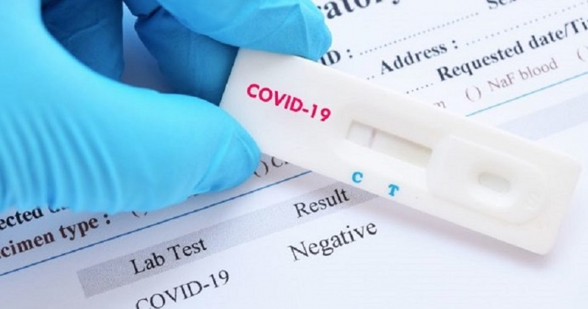Test de coronavirus © Wikimedia Commons 