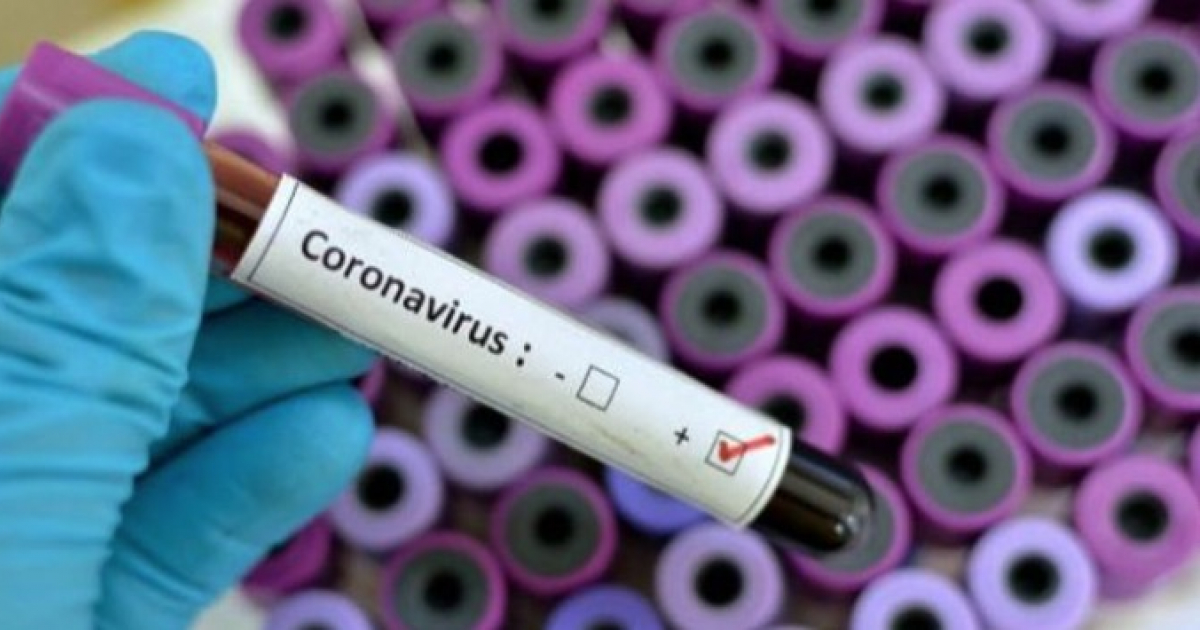 Test de coronavirus © Wikimedia Commons 