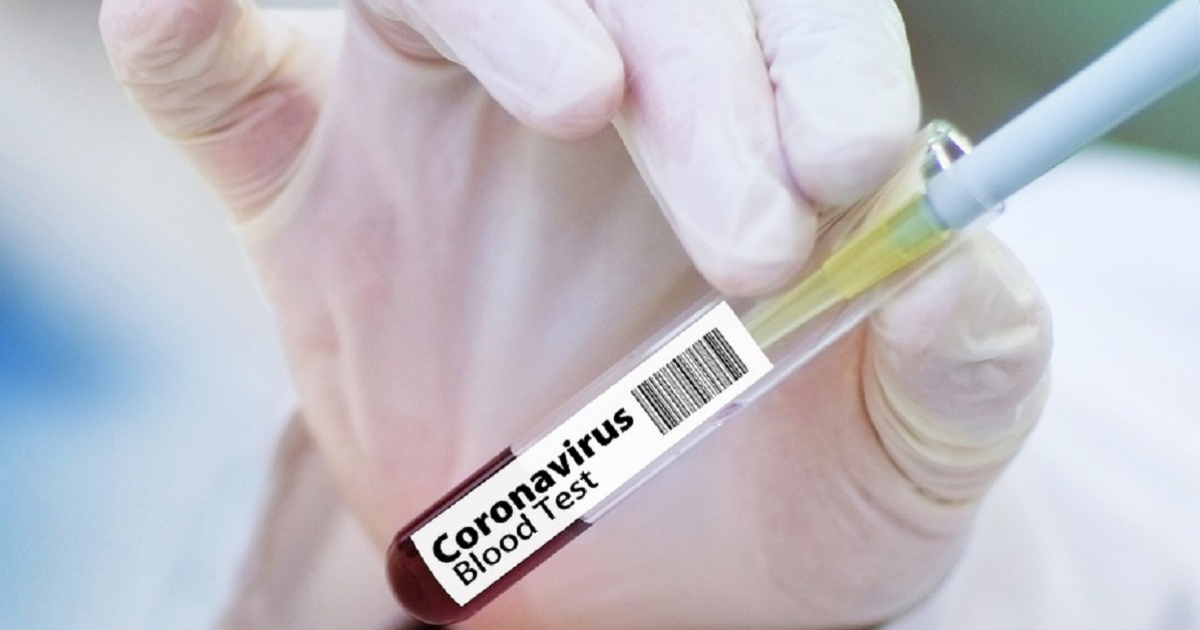 Test de coronavirus (imagen referencial) © Pixabay