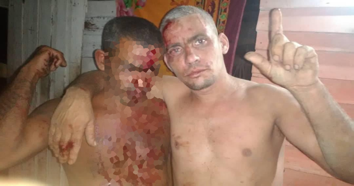 Orestes Varona Medina (a la derecha) tras la agresión en su casa. © Facebook / José Luis Acosta 