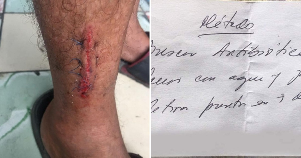 Imagen de la herida y del método que fue indicado por la doctora cubana. © Facebook / Alexis Hernández