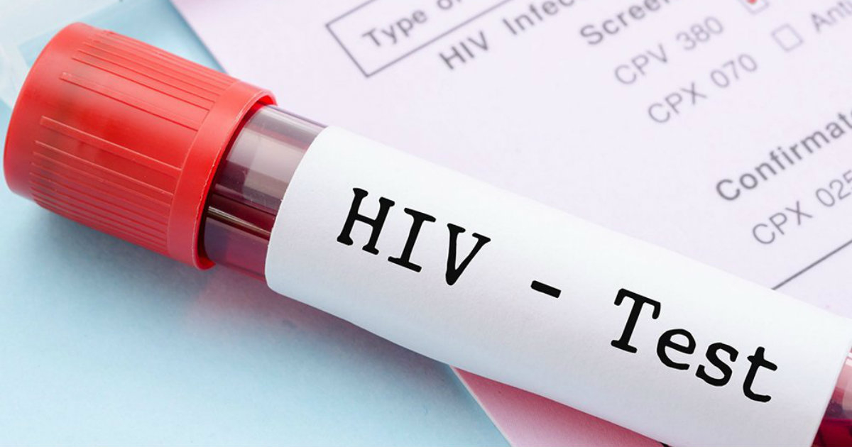 Test de sangre de VIH (referencia) © Pixabay