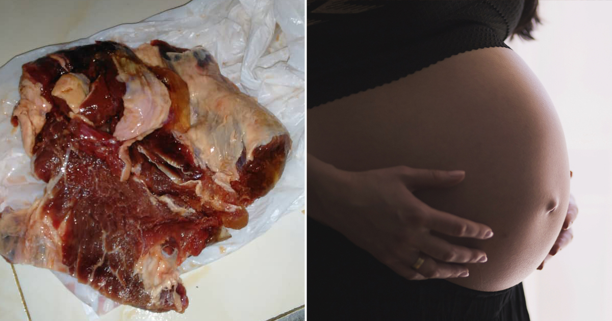 carne de res de "dieta" que reciben mujeres embarazadas en Cuba. © CiberCuba