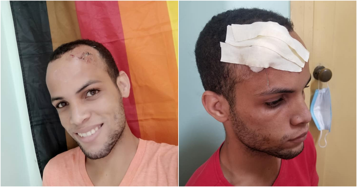 Activista Raúl Soublett con lesiones en su frente causadas durante el interrogatorio © Facebook Raúl Soublett y Hector Luis Valdes
