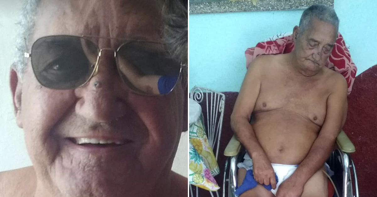 Anciano cubano antes y después de la negligencia médica. © CiberCuba
