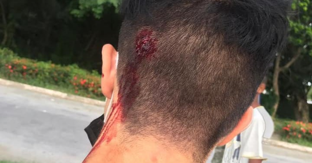 Joven con una herida en la cabeza tras las protestas © Facebook