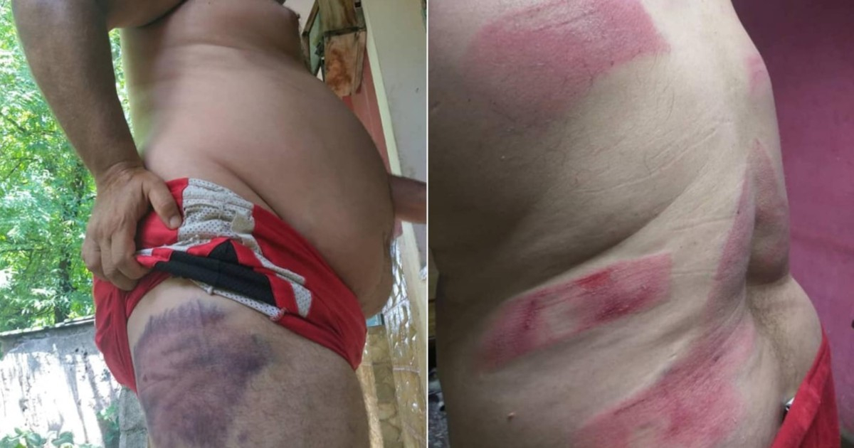 Imágenes de las lesiones provocadas por la brutal paliza © Facebook / Pompy Pedroso