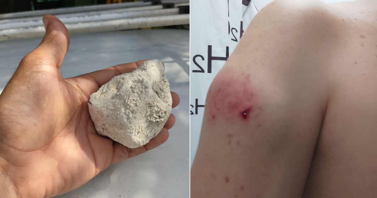Fragmento de la piedra (i) y El hombro del conductor tras la pedrada (d) © Collage Facebook/Accidente Buses & Camiones